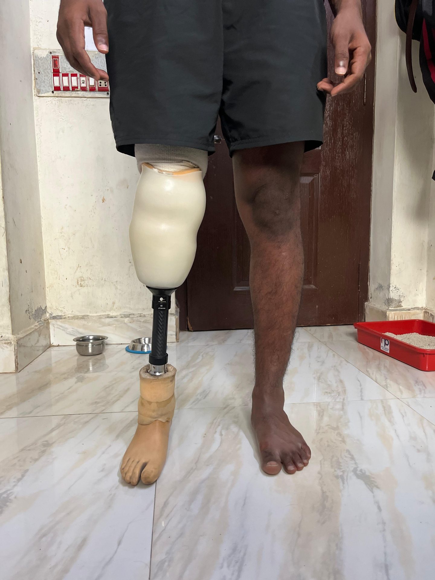 3D printed prosthetic leg cover worn — social impact design